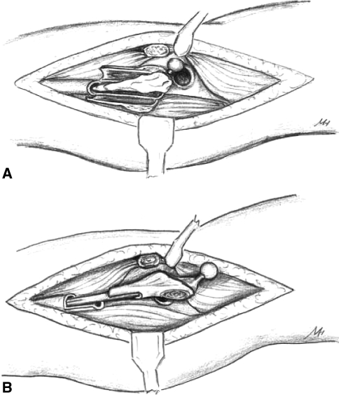 Fig. 1A–B