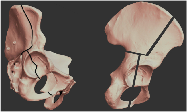 Fig. 1