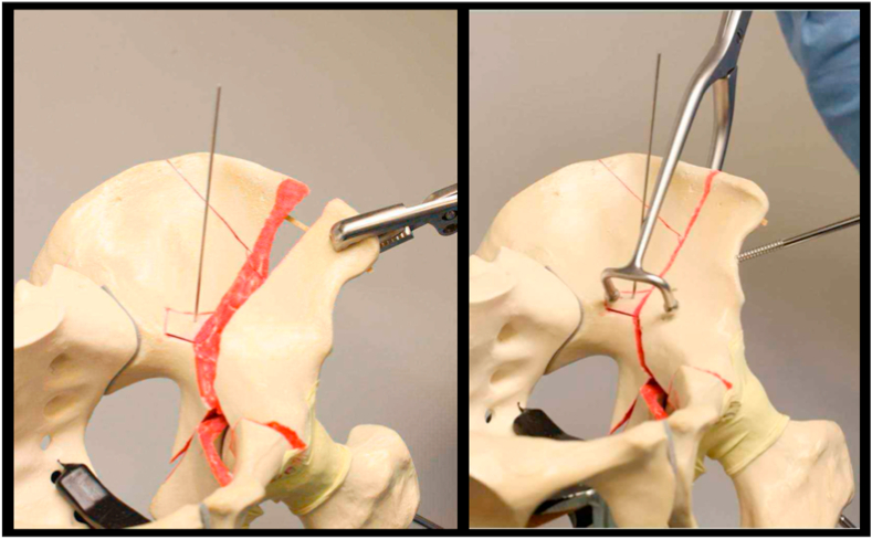 Fig. 11