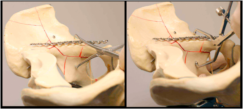 Fig. 12