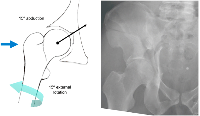 Fig. 4