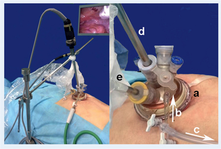 Figure 1: