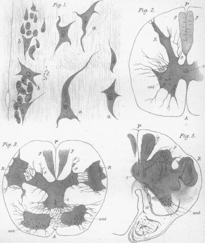 Figs. 1-3, 5