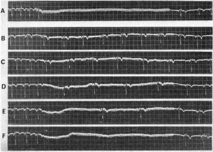 Fig. 22