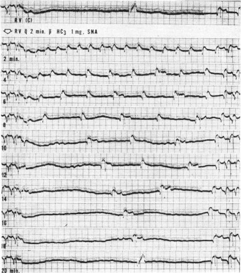 Fig. 33