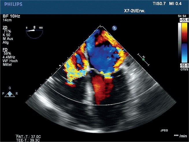 Fig. 2