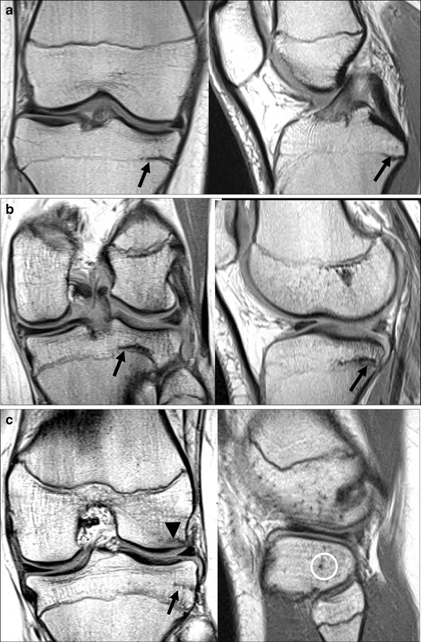 Fig. 11