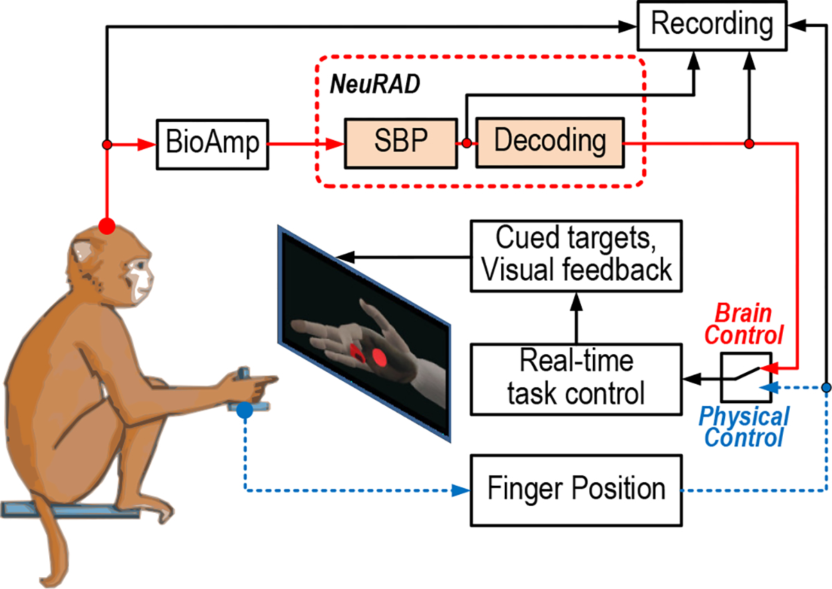 Image of Patient with Brain Device