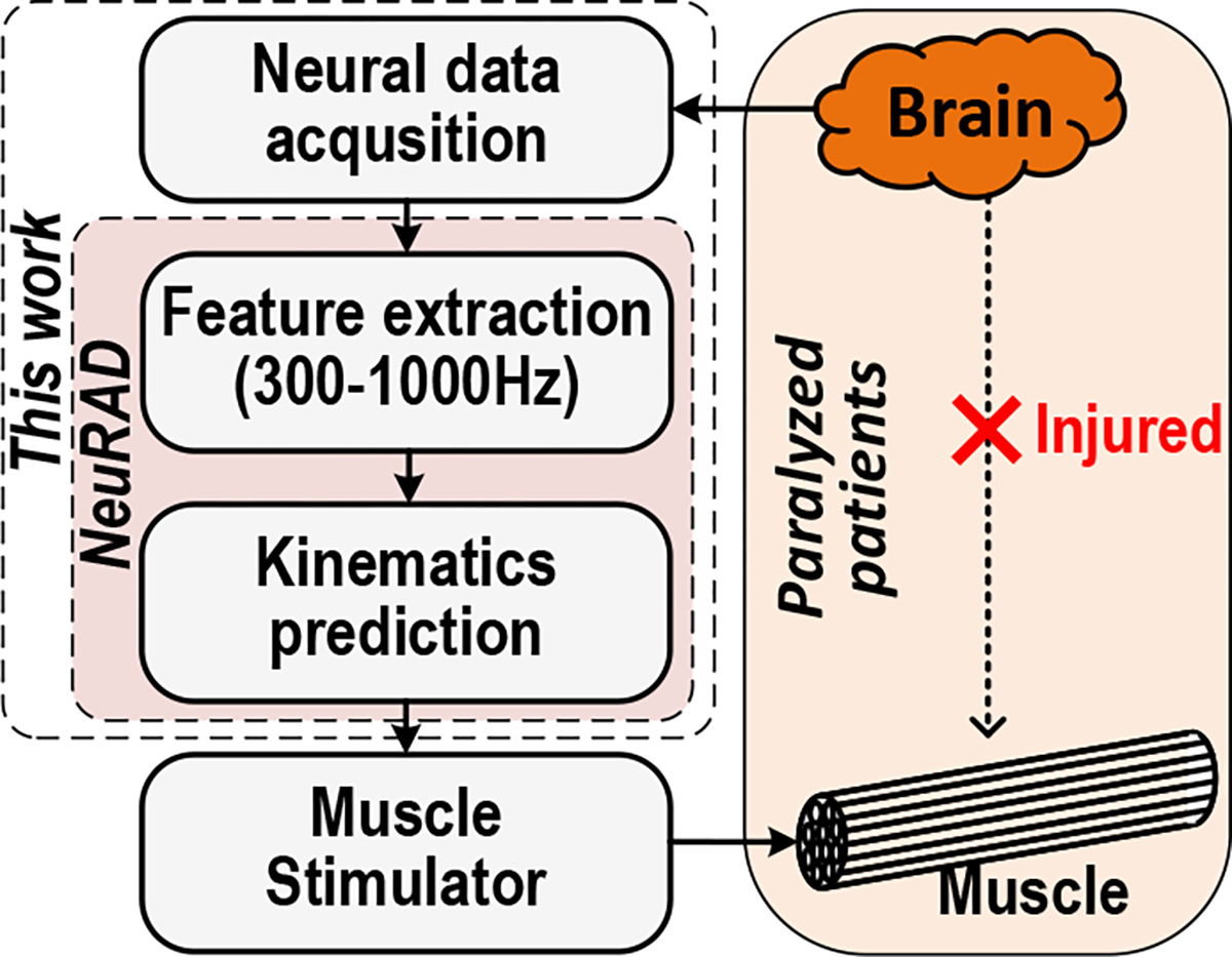 Image of Brain Implant Technology