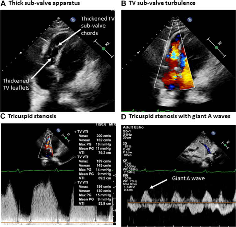 Figure 3