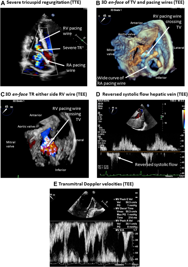 Figure 2