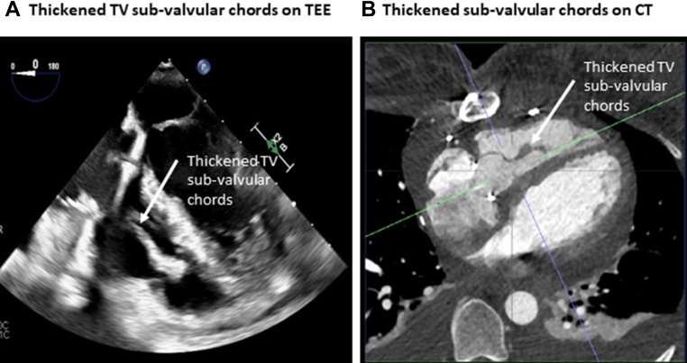 Figure 4