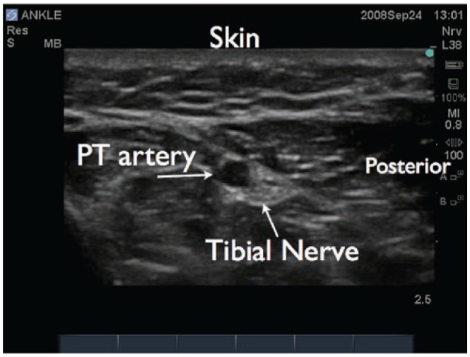 Figure 29