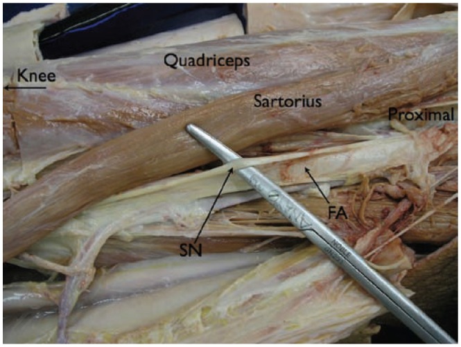 Figure 26