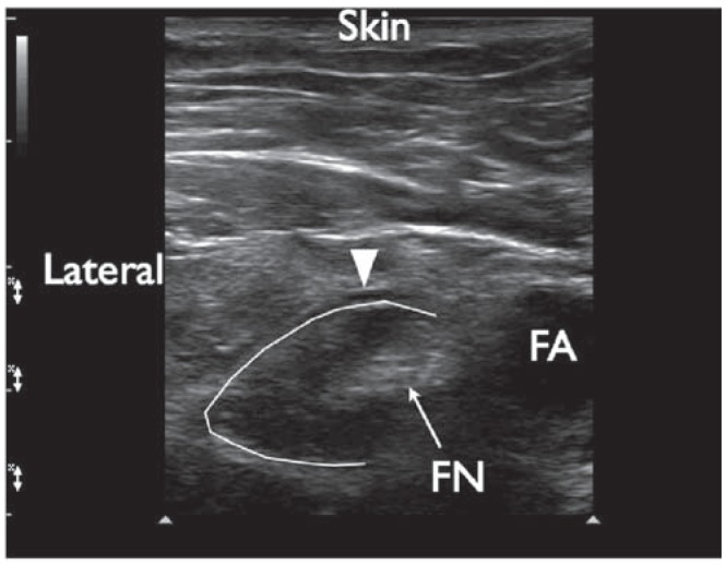 Figure 17