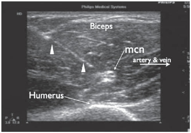 Figure 12