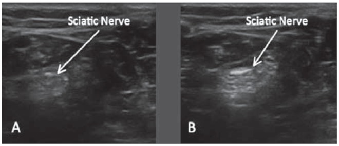 Figure 25