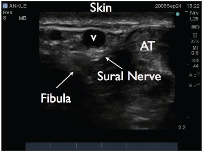 Figure 28