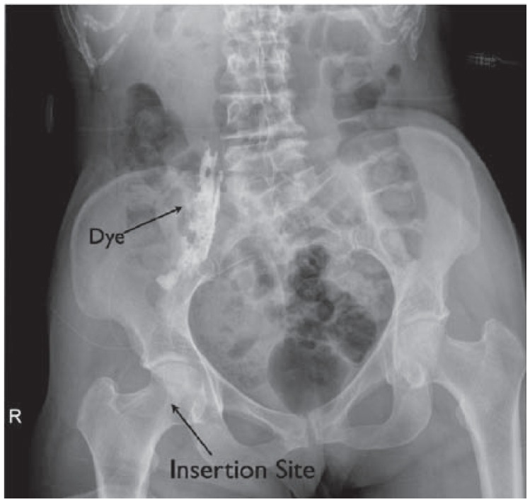 Figure 18