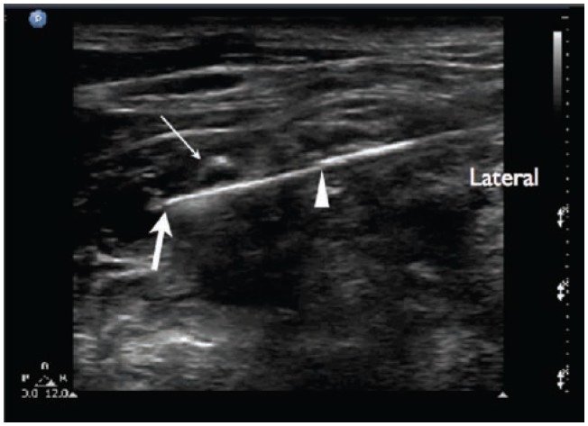 Figure 10