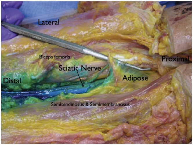 Figure 21