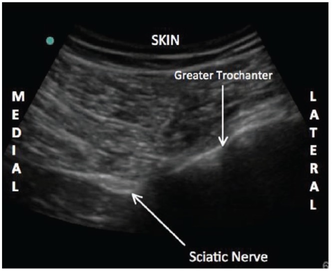 Figure 20