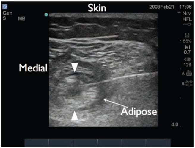 Figure 22