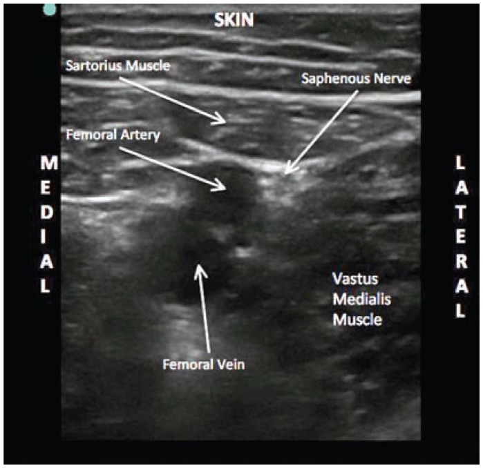 Figure 27