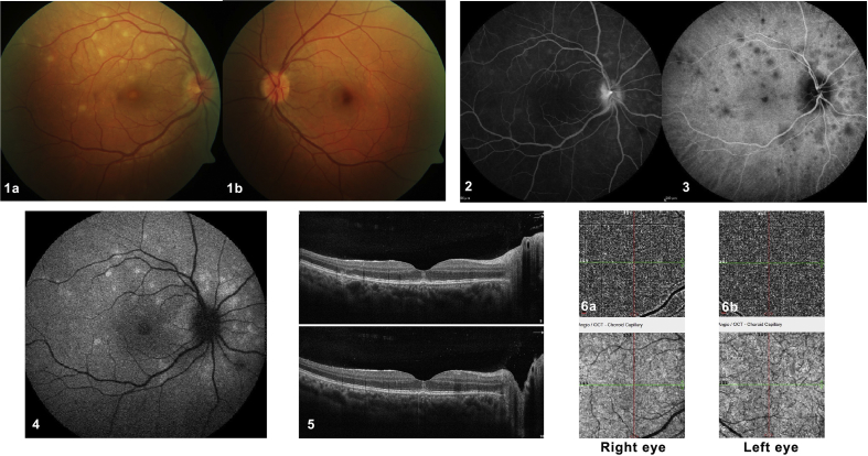 Fig. 2