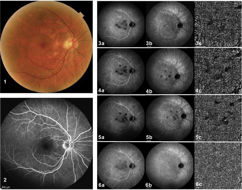 Fig. 3