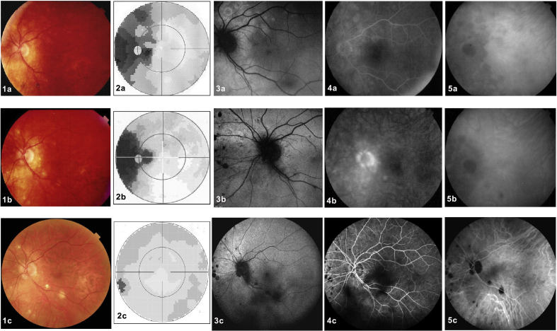 Fig. 1