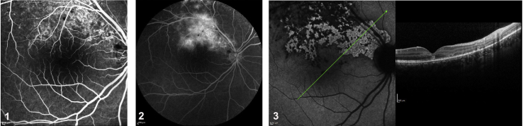 Fig. 4