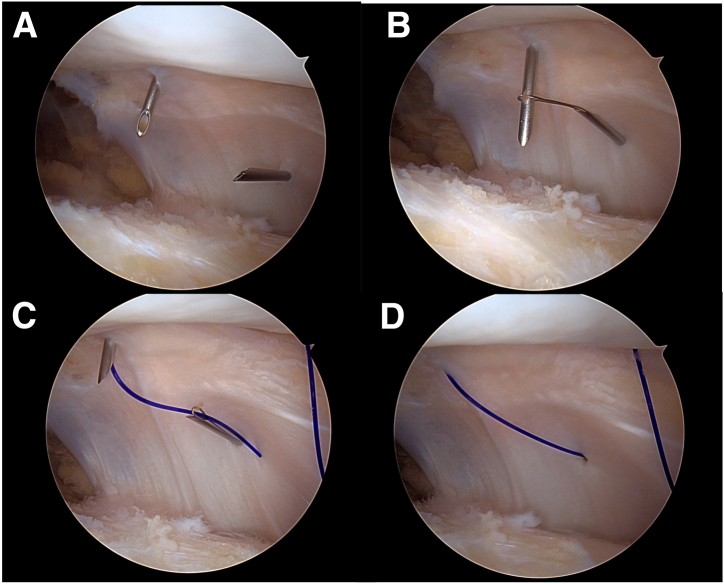 Fig 1