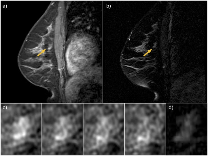 Fig 4