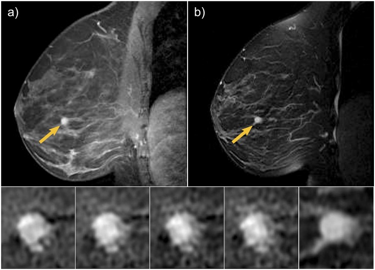 Fig 5