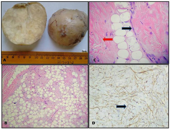 [Table/Fig-2]: