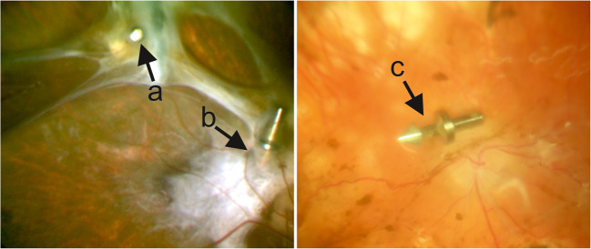 Fig. 1