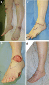 Fig. 1