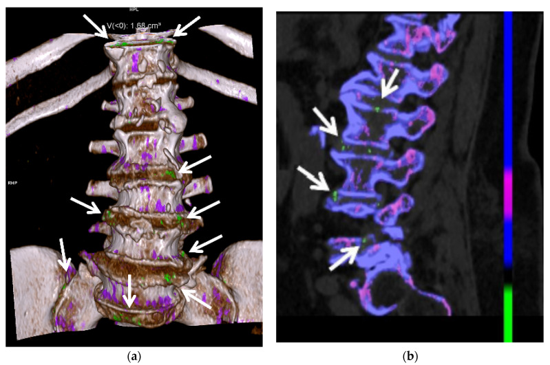 Figure 14