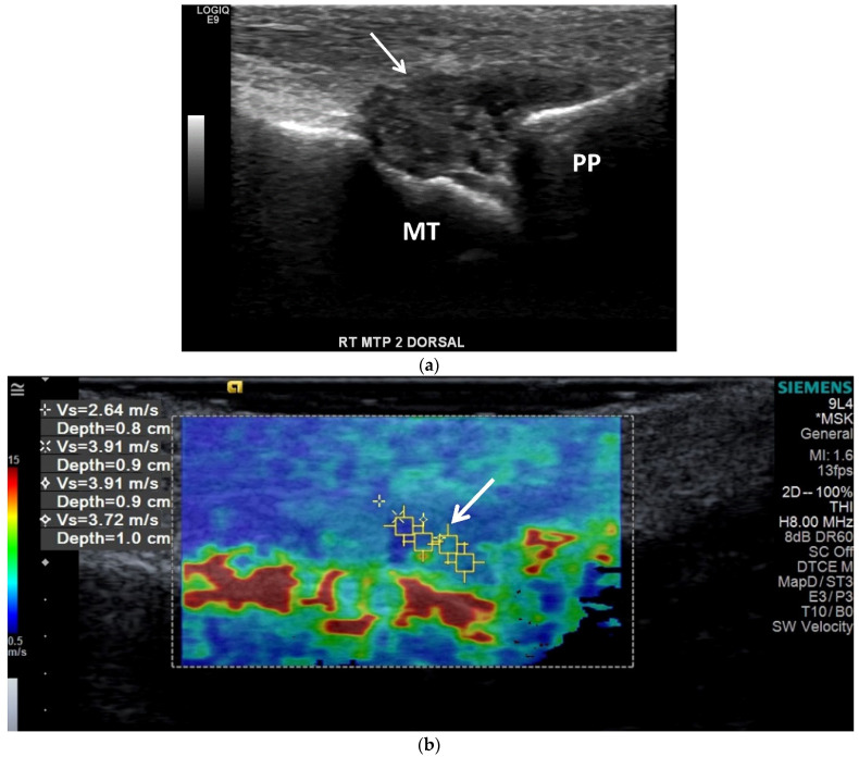 Figure 11