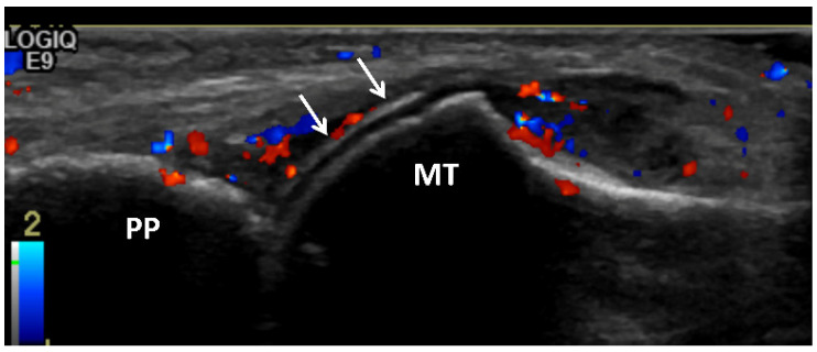 Figure 9