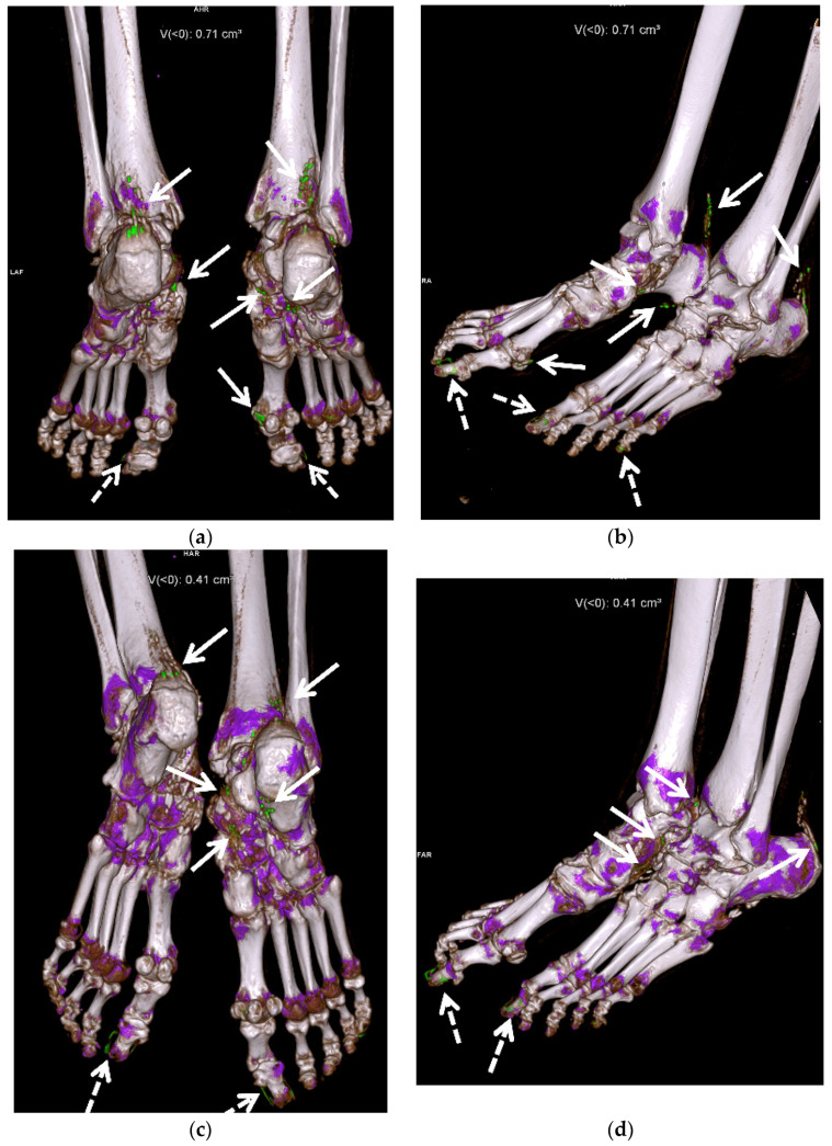 Figure 12