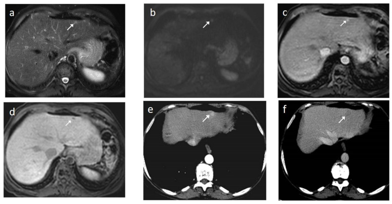 Figure 11