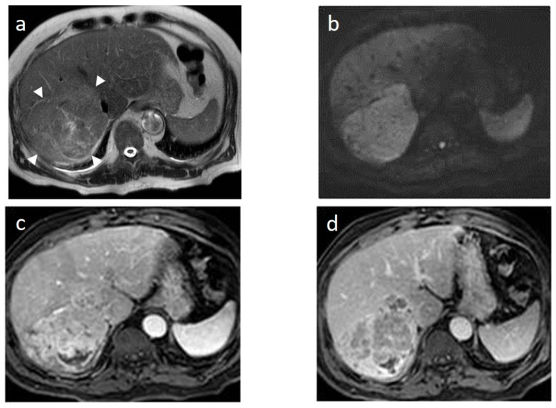 Figure 14