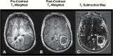 Fig 2.