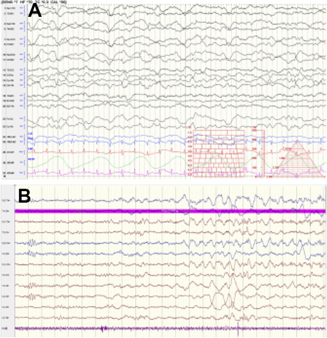 Figure 5.