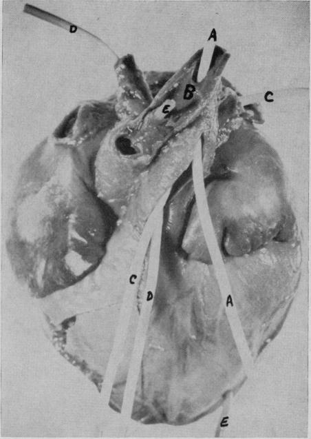 Fig. 4a