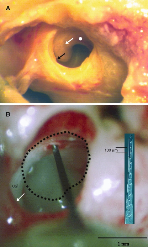 FIG. 3