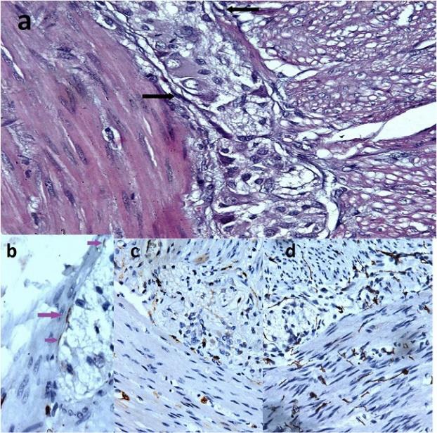 Figure 1- a)