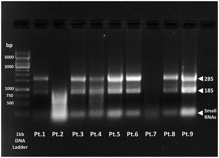 Picture of an agarose gel showing representative bands pattern of RNA extracts (28S subunit, 18S subunit and small RNAs), including high- and low-concentrated RNAs, and a degraded RNA.